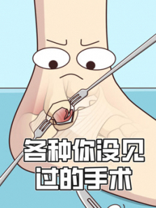 各种你没见过的手术