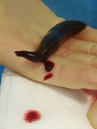 ѪҺ�����Ķ���ȼ��